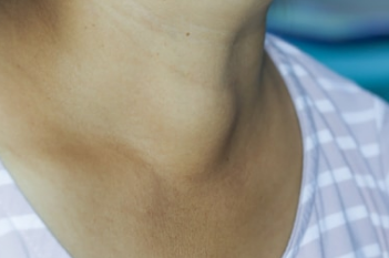 How do we identify thyroid problems?
